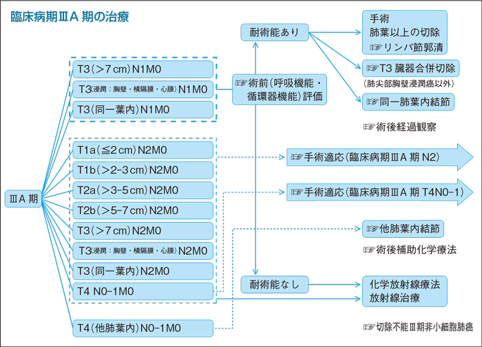 臨床病期Ⅲ期の治療