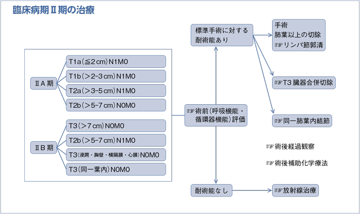 臨床病期Ⅱ期の治療