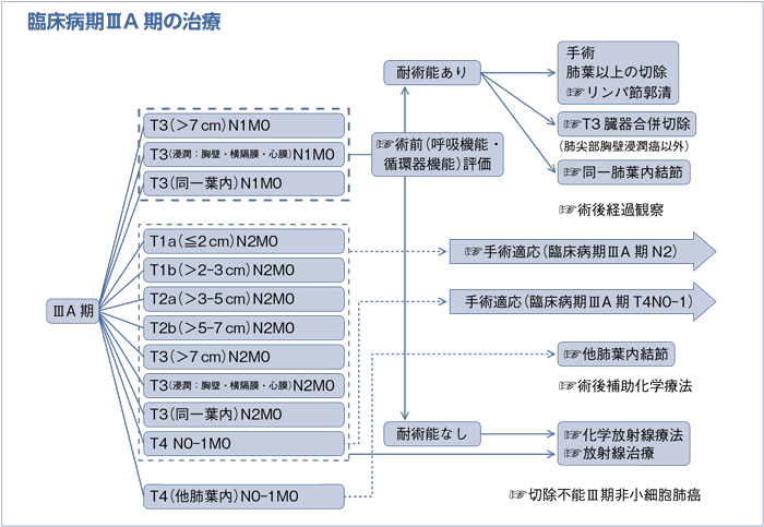 臨床病期Ⅲ期の治療