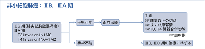 非小細胞肺癌：ⅡB，ⅢA期