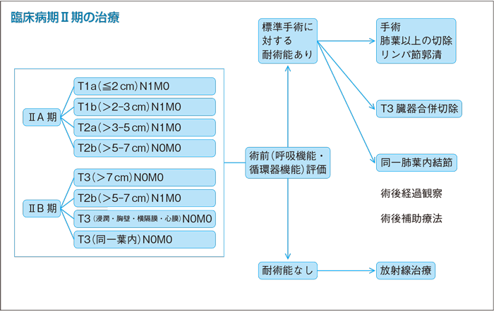 臨床病期Ⅱ期の治療