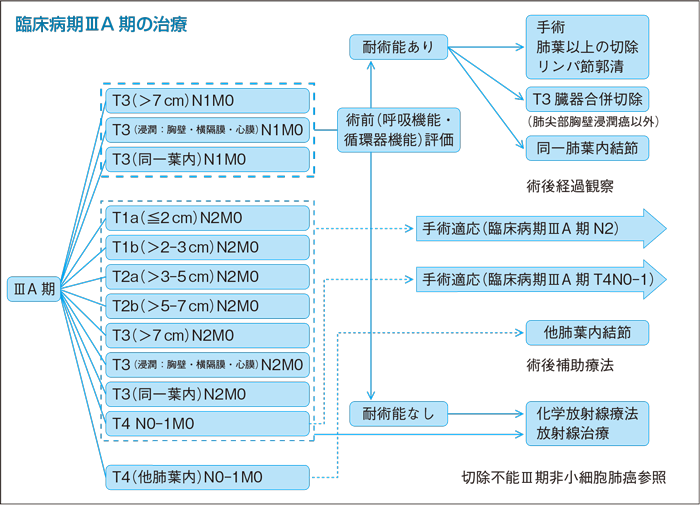 臨床病期Ⅲ期の治療
