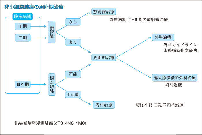 非小細胞肺癌の周術期治療