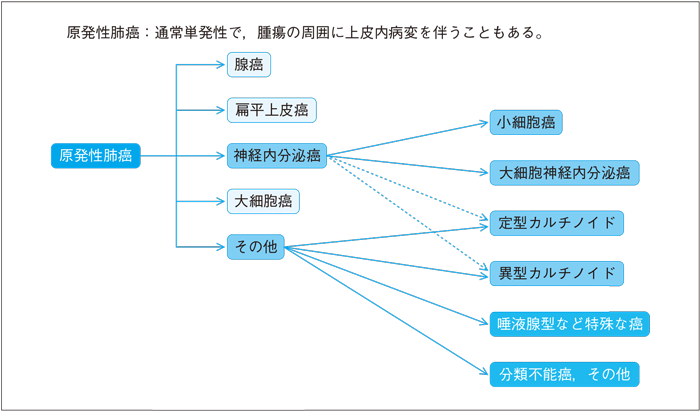 Ⅴ．原発性肺癌