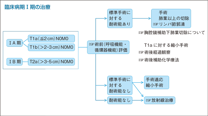 臨床病期Ⅰ期の治療